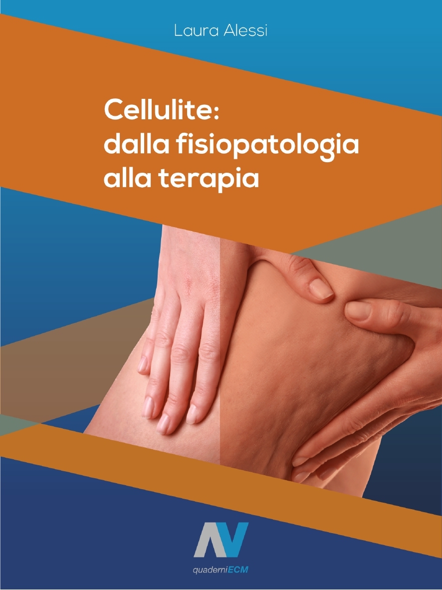 rimedi cellulite - trattamenti anticellulite - liposcultura - liposuzione cosce