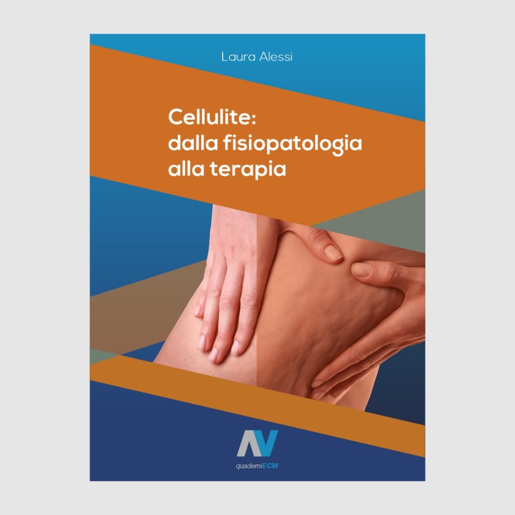 rimedi cellulite - trattamenti anticellulite - liposcultura - liposuzione cosce