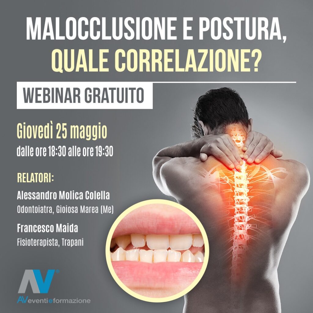 malocclusione